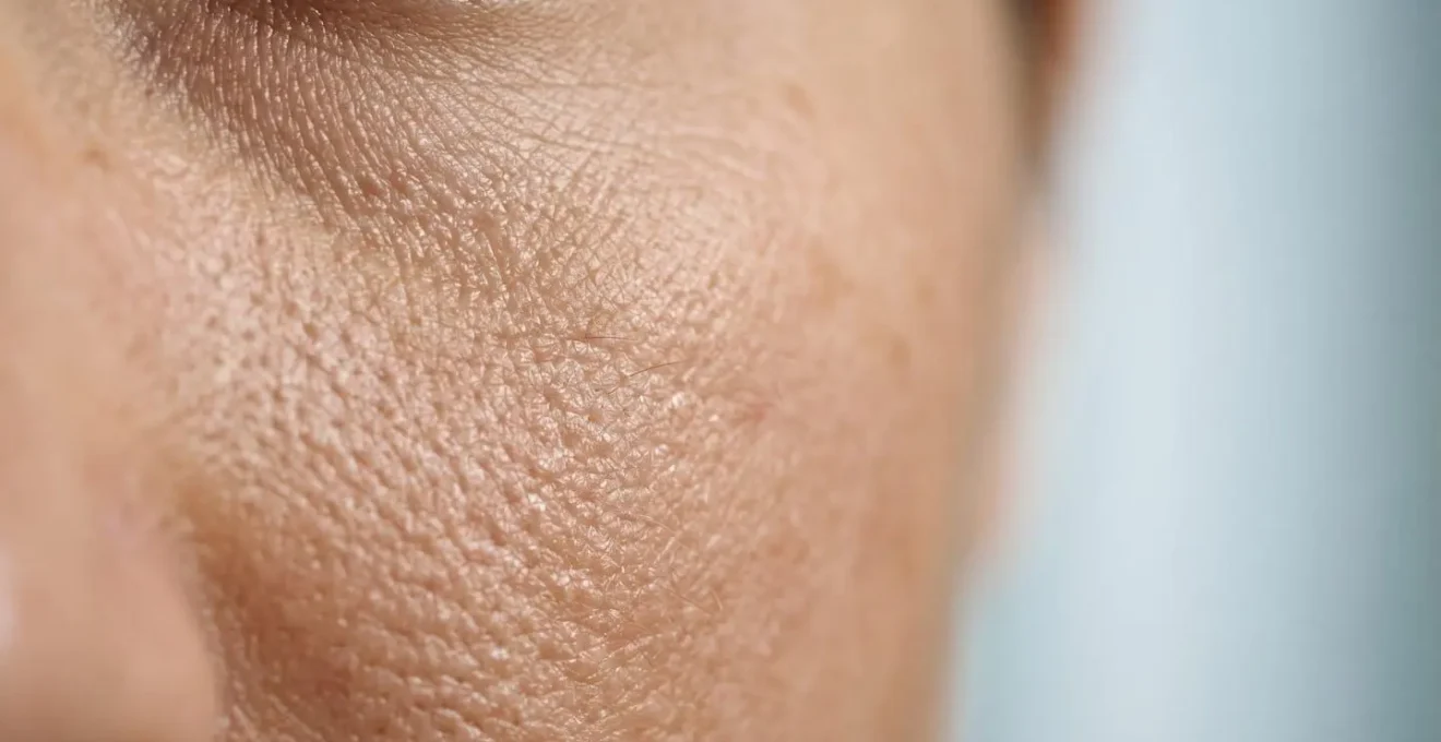 Peau en cours de traitement par peeling médical montrant les différentes couches cutanées